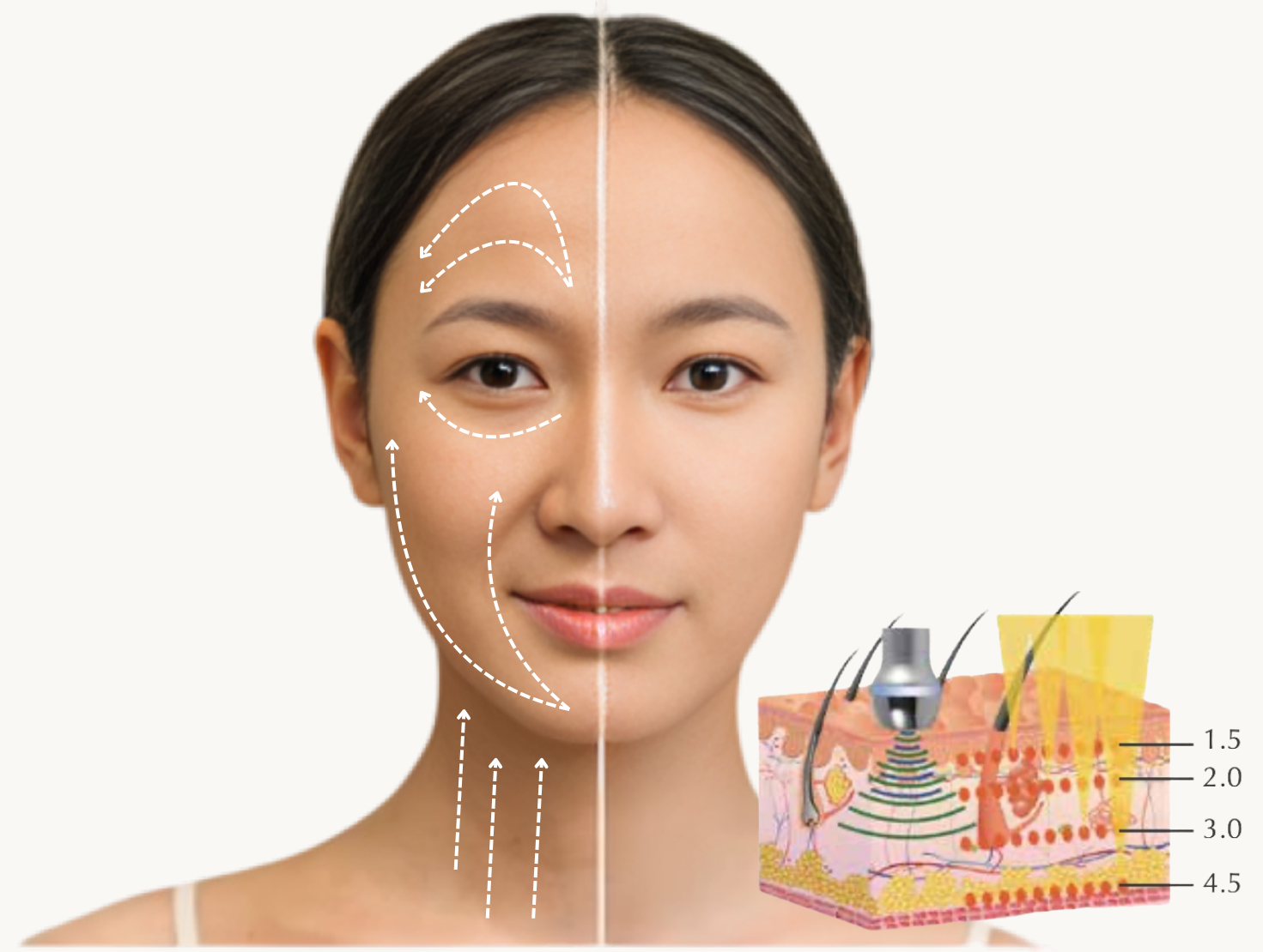 Benefit Left Image